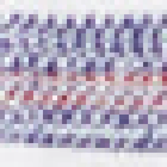 Basket Weave Gradient Stripe Shirt